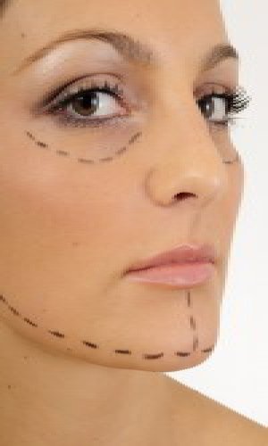 image of a woman preparing for a surgical face lift